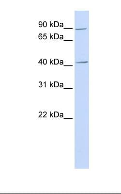 Polyclonal Rabbit anti-Human UBP43 / USP18 Antibody (aa110-159, WB)
