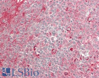 IHC-plus™ Polyclonal Rabbit anti-Human DOT1L / DOT1 Antibody (IHC, WB)