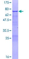 Human VASP Protein (Recombinant GST)