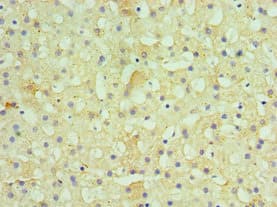 HSD11B1 / HSD11B Antibody (aa25-292)