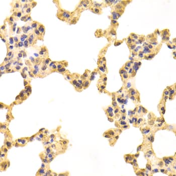 Polyclonal Rabbit anti-Human TXNRD2 Antibody (IHC, WB)