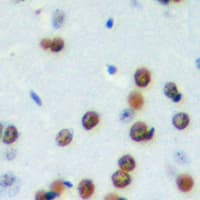 CDCA4 Antibody (Internal)