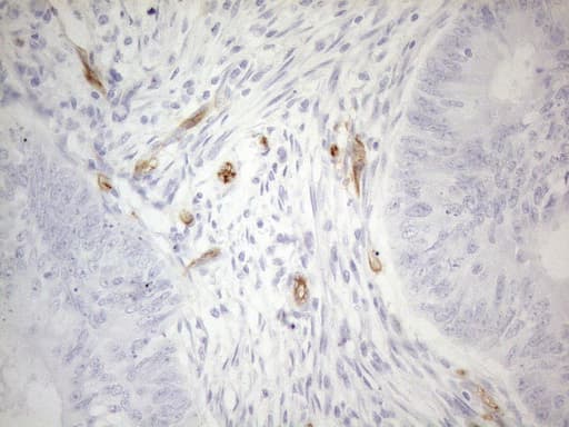 CD34 Antibody (aa312-385, clone OTI10C8)