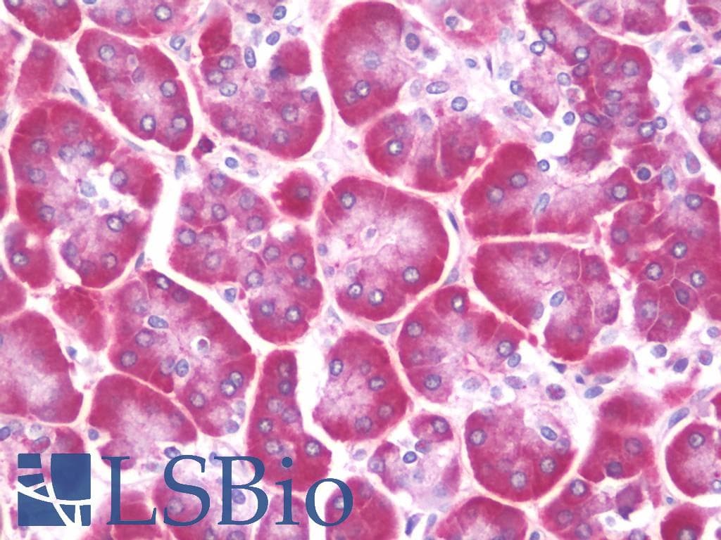 IHC-plus™ Polyclonal Rabbit anti-Human CFTR Antibody (Glu733, IHC, WB)
