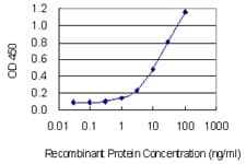 ABO Glycosyltransferase Antibody (clone 1B7)