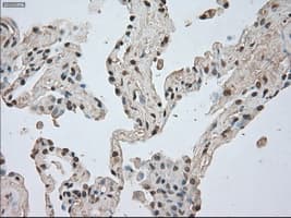 Monoclonal Mouse anti-Human BUB1B / BubR1 Antibody (clone OTI10B7, IHC, IF, WB)