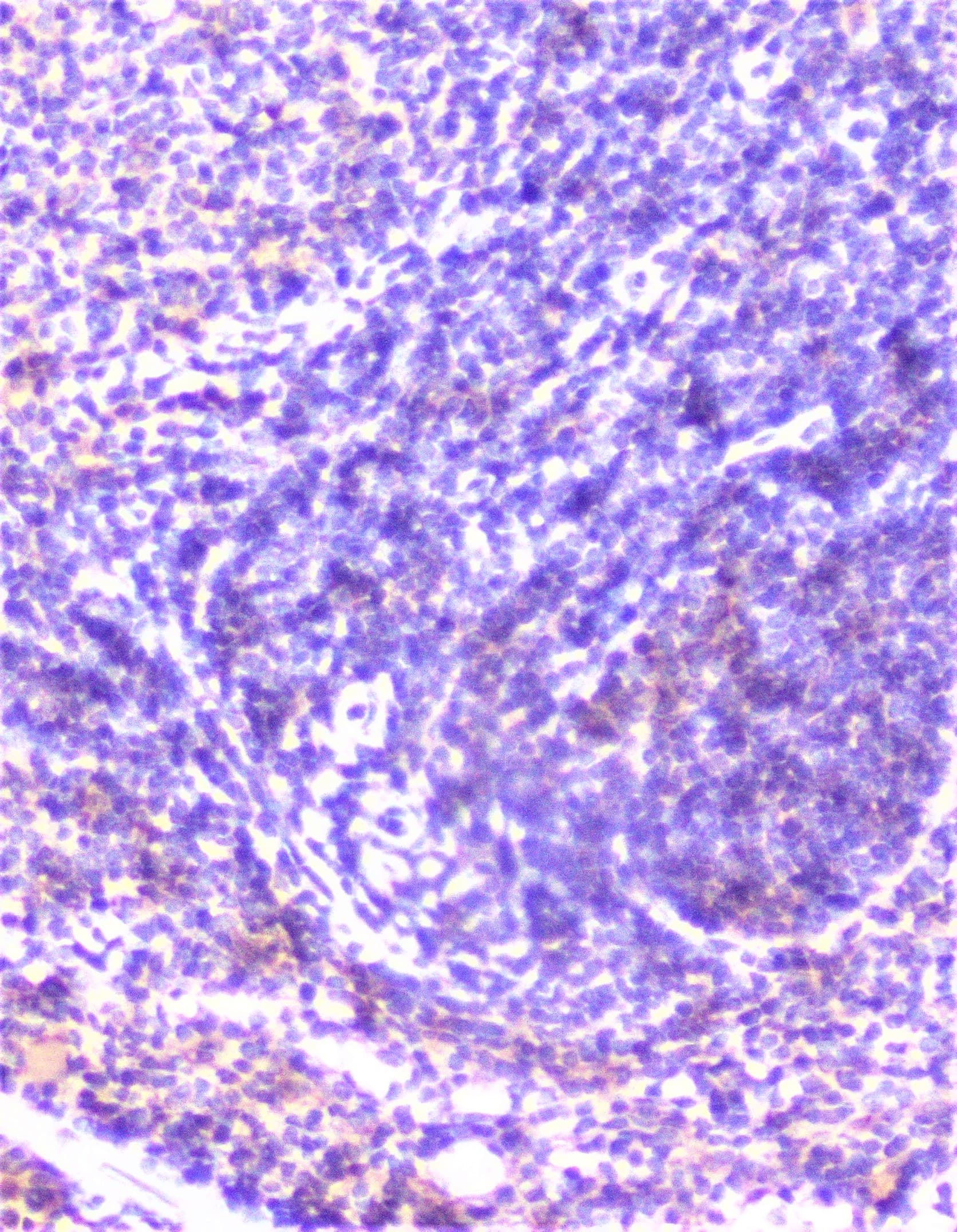 CTTN / Cortactin Antibody
