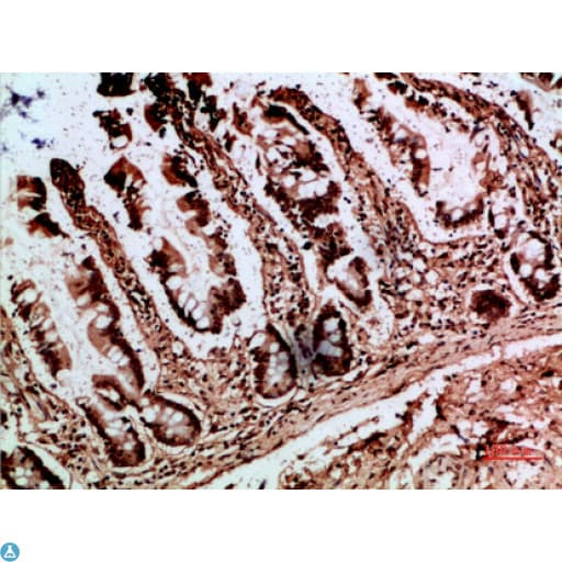 POU2AF1 / BOB1 Antibody