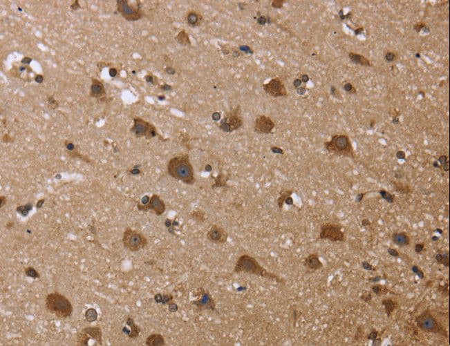 Polyclonal Rabbit anti-Human MYD118 / GADD45B Antibody (IHC)