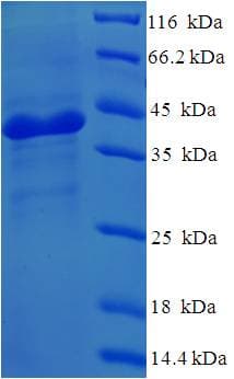 Human NMNAT3 Protein (Recombinant His-SUMO)