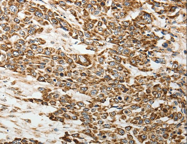 SELE / CD62E / E-selectin Antibody