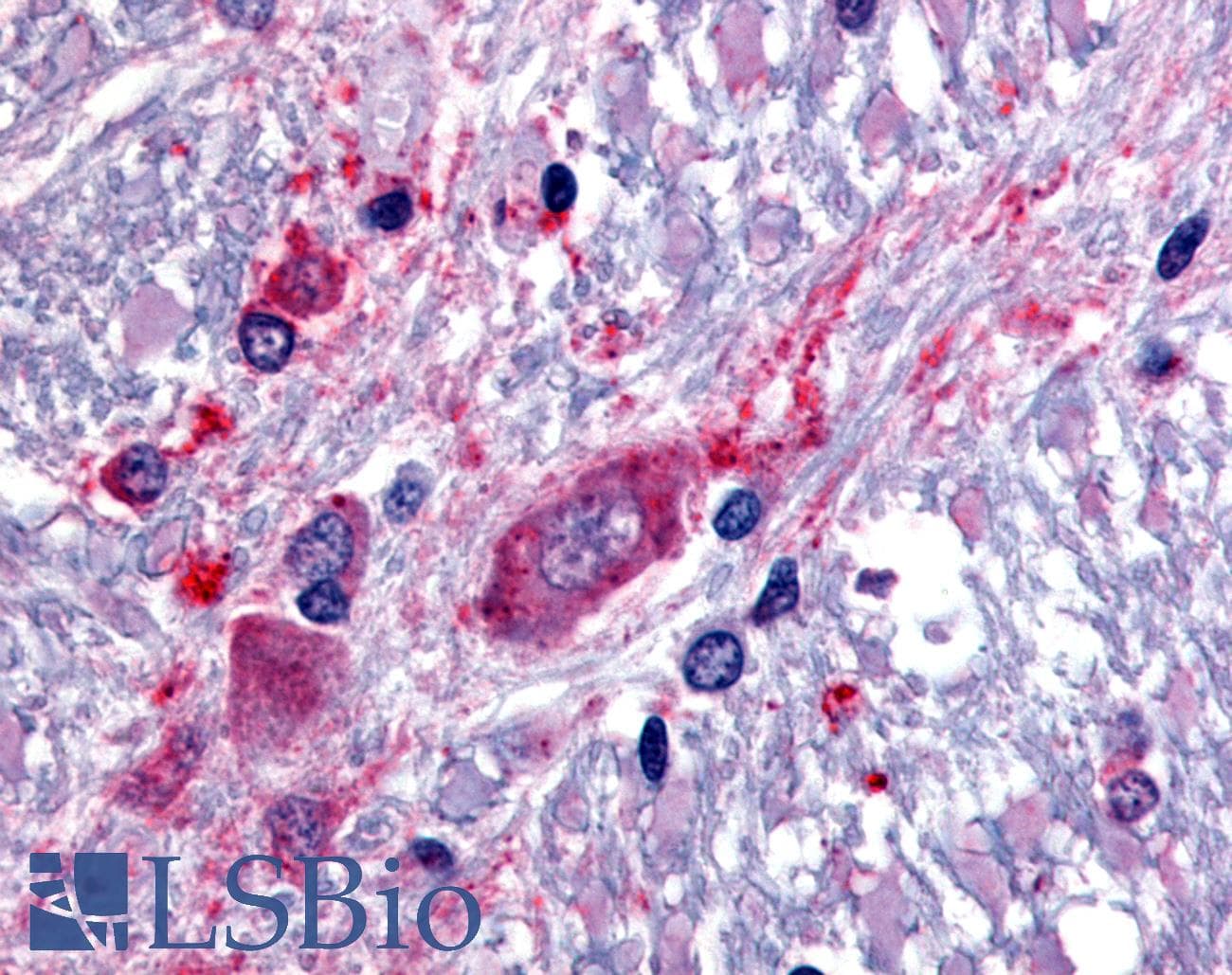 IHC-plus™ Polyclonal Rabbit anti-Human SLC5A3 Antibody (C-Terminus, IHC)