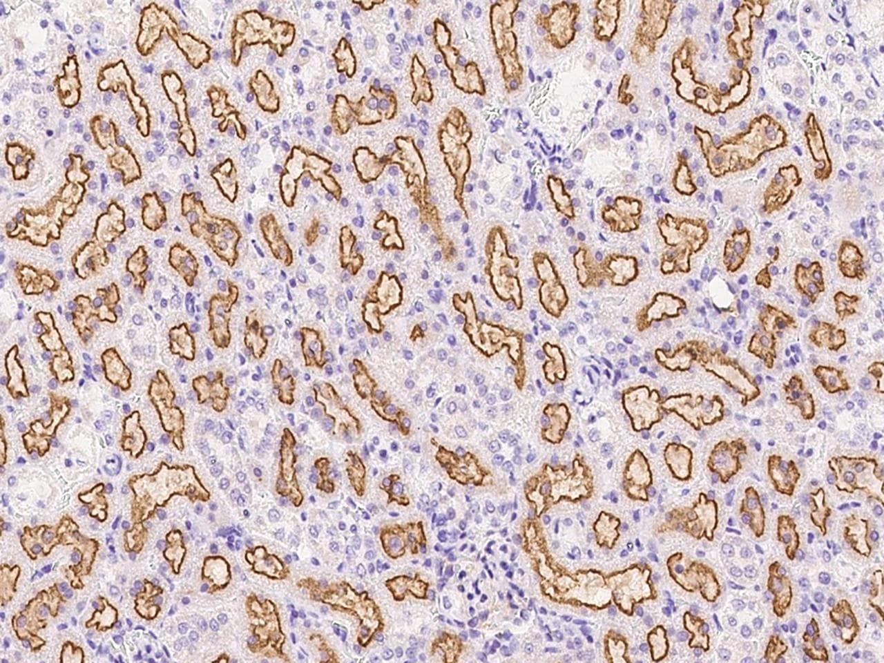 EPHB2 / EPH Receptor B2 Antibody (Preservative Free)
