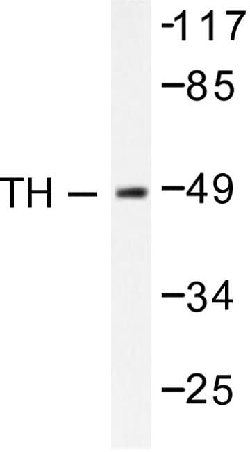 TH / Tyrosine Hydroxylase Antibody (Gly13)