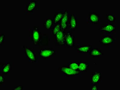 IHC-plus™ PHF5A / INI Antibody