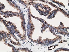 ERGIC-53 / LMAN1 Antibody (clone OTI1A8)