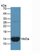 FABP1 / L-FABP Antibody (aa2-127, APC)