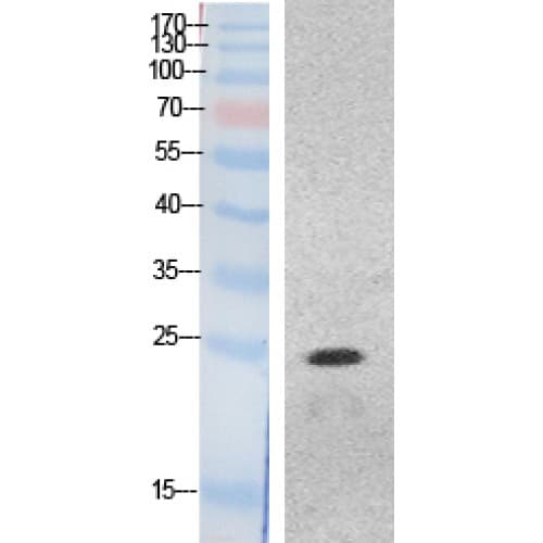 Polyclonal Rabbit anti-Human HMG1 / HMGB1 Antibody (N-Terminal, IHC, WB)