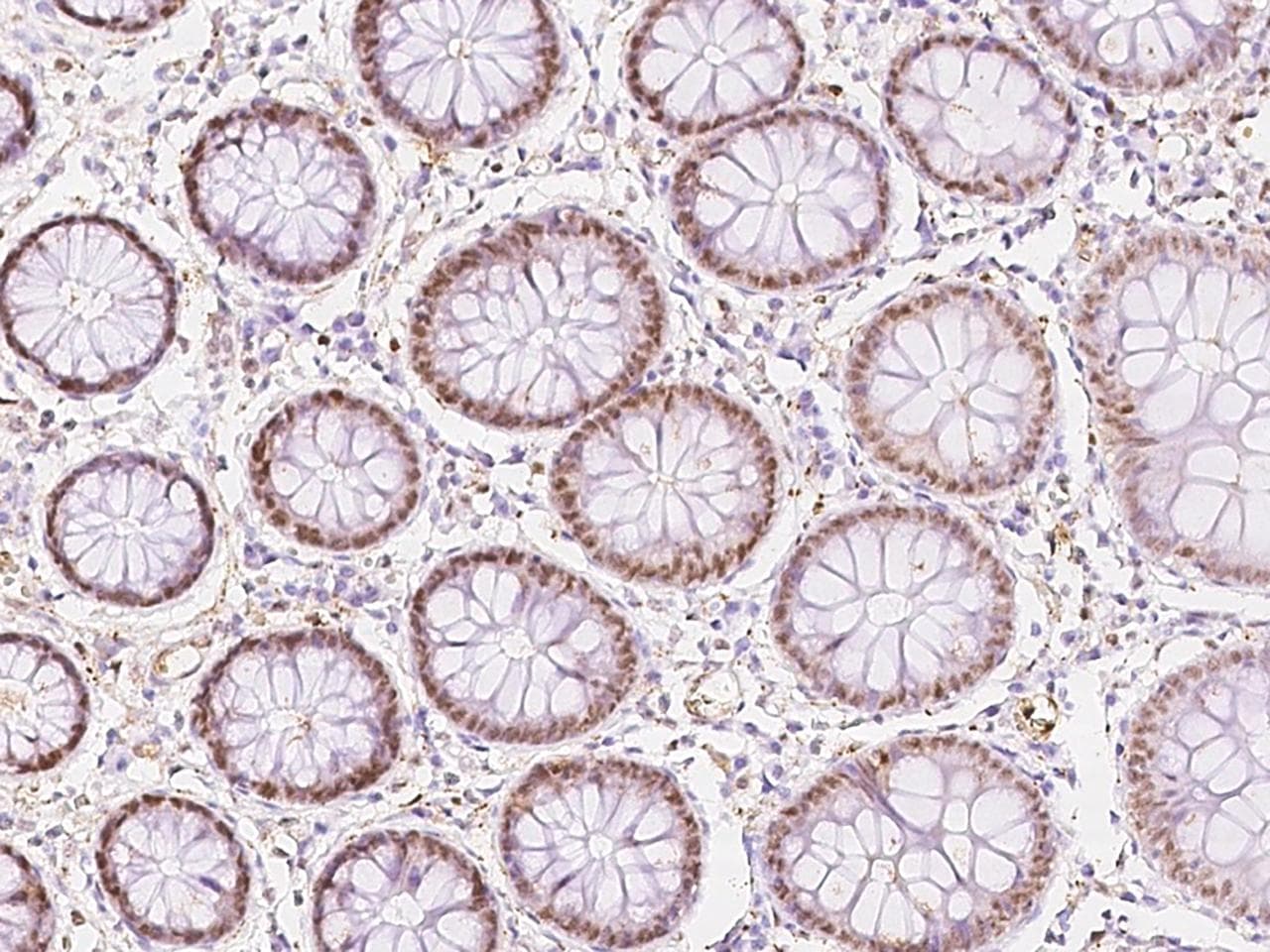 RCC2 Antibody