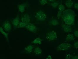 KIAA0517 / TRIM2 Antibody (clone OTI3B5)