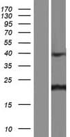 CNBP / ZNF9 Protein (Over-Expression Lysate Myc-DDK (Flag))