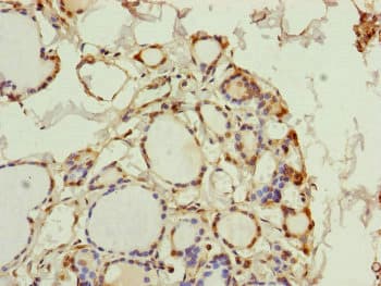 PGLS / 6PGL Antibody