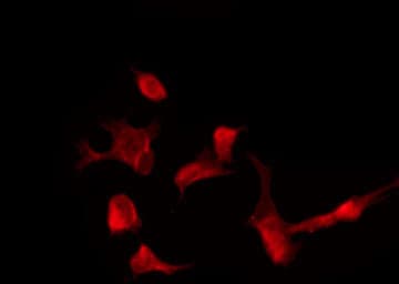 MAGI2 / AIP-1 Antibody