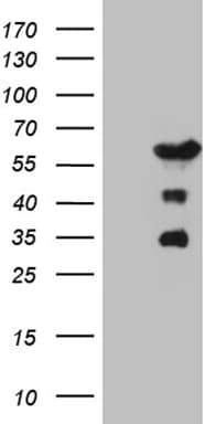 Monoclonal Mouse anti-Human PATZ1 / PATZ Antibody (clone OTI2H4, WB)