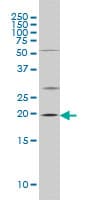Monoclonal Mouse anti-Human CRYAB / Alpha B Crystallin Antibody (clone 1A10-1A4, WB)