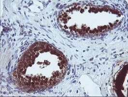CMPK / CMPK1 Antibody (clone OTI1H8)