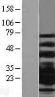 CD79B / CD79 Beta Protein (Over-Expression Lysate Myc-DDK (Flag))
