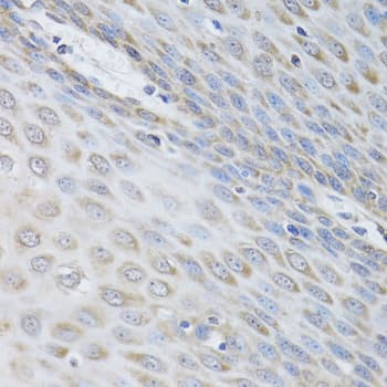 IKBKG / NEMO / IKK Gamma Antibody