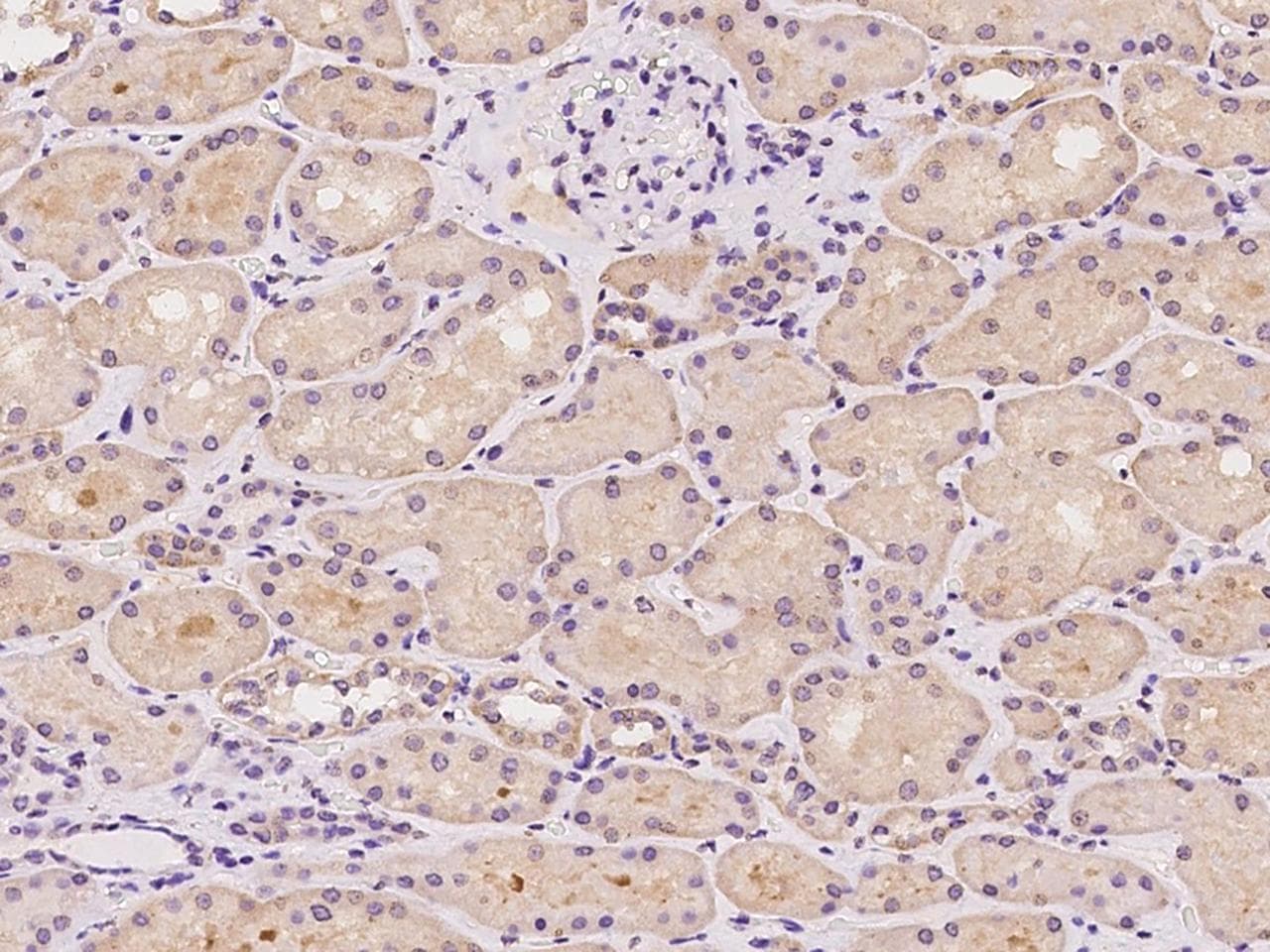 YARS2 Antibody