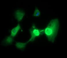 TP73 / p73 Antibody (clone OTI2H5)
