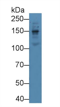 LAMB1 / Laminin Beta 1 Antibody (aa1053-1258)