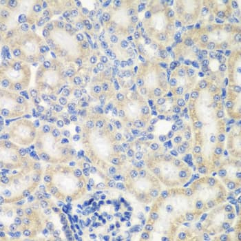 NAA50 / NAT13 / SAN Antibody