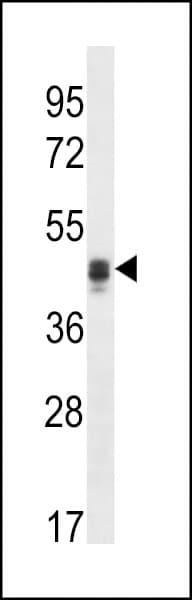 CALU / Calumenin Antibody (aa217-246)