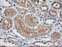 ALS2CR1 / NIF3L1 Antibody (clone OTI2B7)