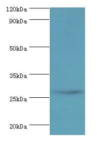 CRISP2 / TSP1 Antibody (aa22-243)