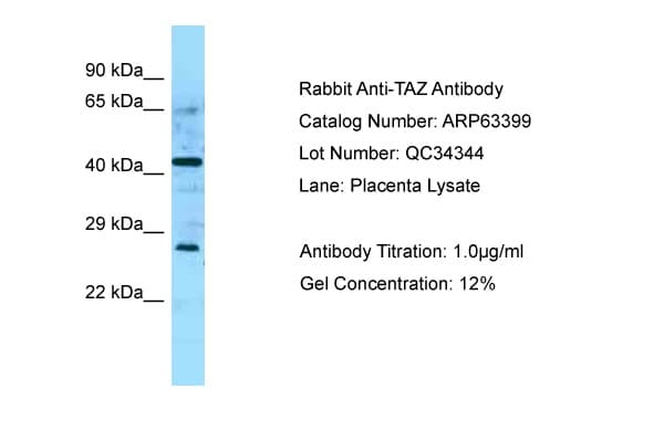 TAZ Antibody (aa192-241)