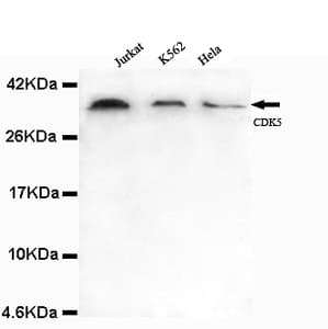 Monoclonal Mouse anti-Human CDK5 Antibody (N-Terminus, IF, WB)