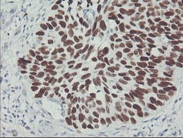 TP53 / p53 Antibody (clone OTI1C6)