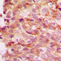 Polyclonal Rabbit anti-Human COL4A1 / Collagen IV Alpha1 Antibody (N-Terminus, IHC, WB)