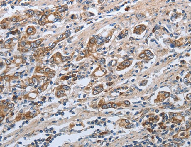 IHC-plus™ SLC34A2 / NaPi-2b Antibody (C-Terminus)
