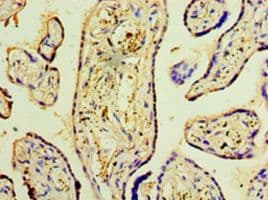 DNAH3 Antibody (aa1-150, Biotin)
