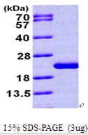 Human NUDT1 / MTH1 Protein (Recombinant His)