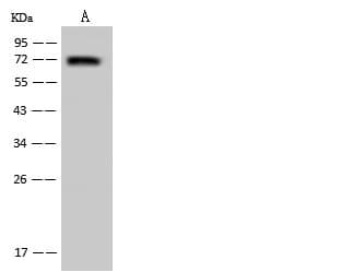 UTP18 Antibody