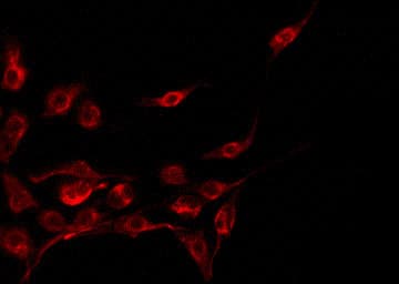 Polyclonal Rabbit anti-Human CST11 Antibody (IF, WB)