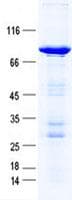 Human KRT7 / CK7 / Cytokeratin 7 Protein (Recombinant GST, N-terminus + His, C-terminus)