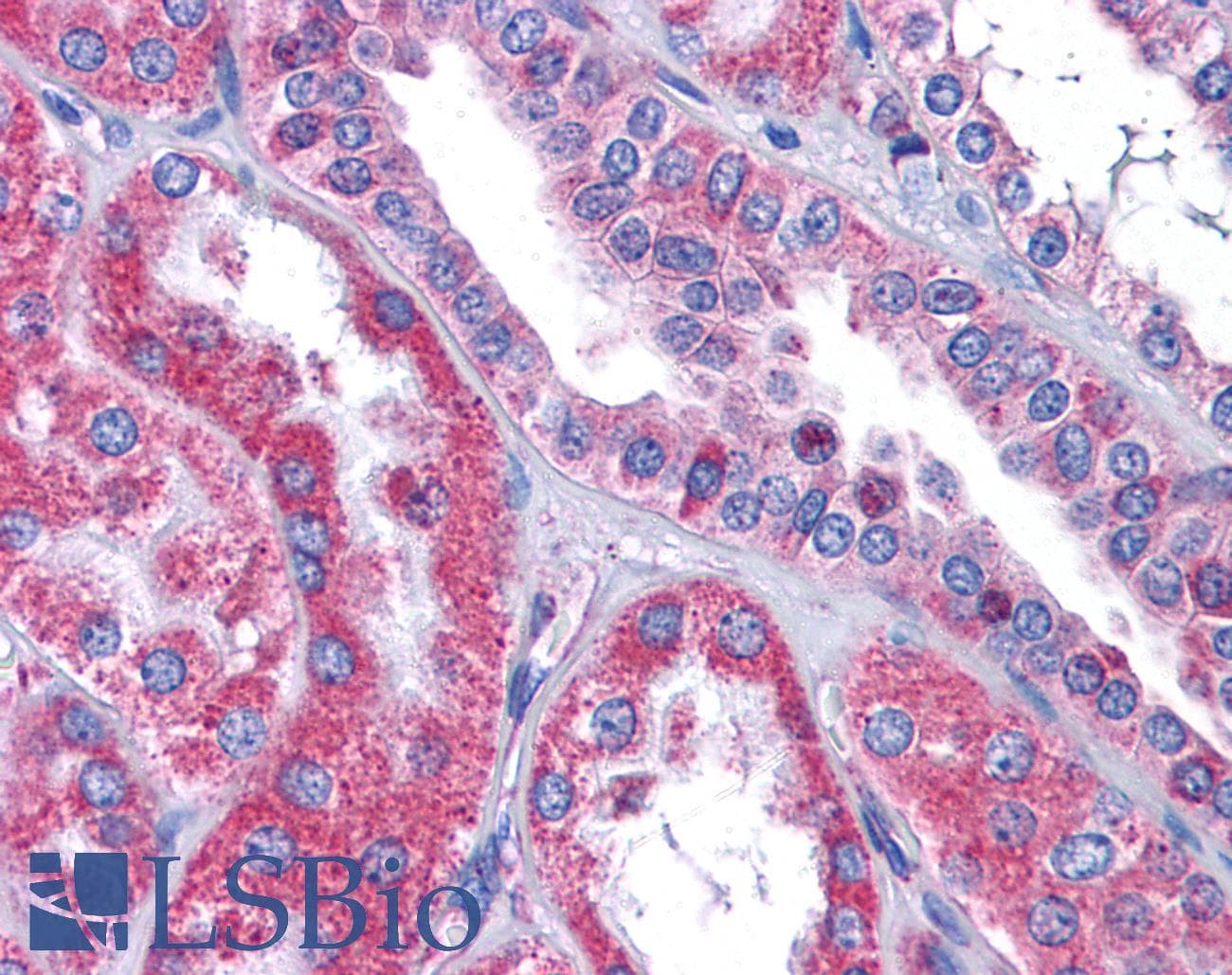 IHC-plus™ GALNT10 Antibody